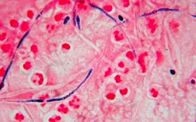 Candida albican